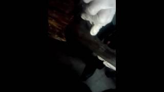 Dissection of arm(9)