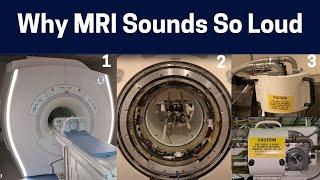 What Makes The Different Sounds In MRI Scans? Knocking to Rhythmic Chirping MRI Sounds Explained