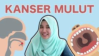 Kanser Mulut