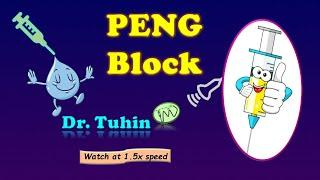 PENG Block | Pericapsular Nerve Group Block | Hip Block | Hip Analgesia