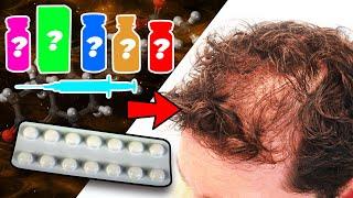 Which Steroids Will Finasteride Prevent Hair Loss From?