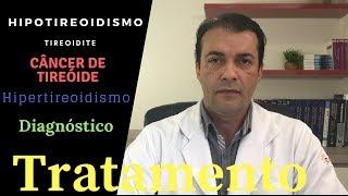 Principais Doenças Da Tireoide [Dr. Rogério Leite]