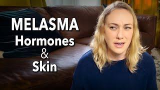 Hormones: Melasma & Your Skin