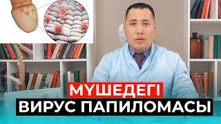 ВПЧ папилома ауруы! Жыныстық қатынас кезінде жұқпалы ма?!