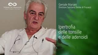 Bambini: ipertrofia delle tonsille e delle adenoidi