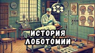 История лоботомии. Как сделали тысячи людей инвалидами