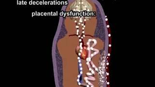 Fetal Heart Rate Monitoring Review (FHR) by Dr. Cal Shipley, M.D.