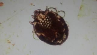 Чесоточный КЛЕЩ  под микроскопом!!!  Itch-mite under a microscope!!!