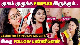 எனக்கு முகம் முழுக்க Pimples இருந்துது! | Rachitha Skin Care