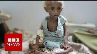 Yemen: On the brink of starvation - BBC News