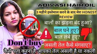 100% original Adivasi Hair oil review after 3 months use | Honest review live result