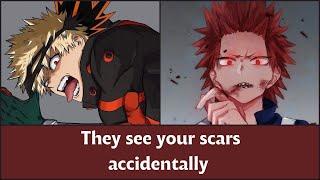 They see your scars - MHA x Listener ASMR