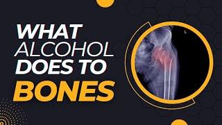 What alcohol really does to your bones