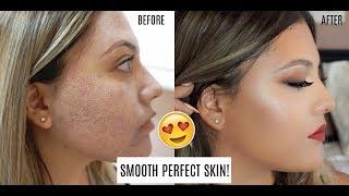 Achieving healthier looking skin with Halo Laser! BEFORE & AFTER