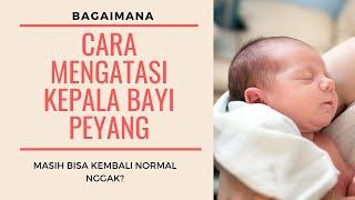 Cara Mengatasi Kepala Bayi Peyang