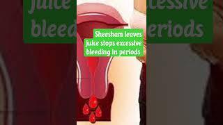 Sheesham leaves juice stops over bleeding in periods #ayurveda#health #menorrhagia #female#herbs