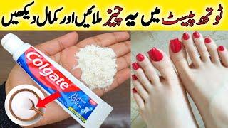 Easy Tan Removal | Hands And Feet Whitening Formula | Manicure Pedicure At Home | Glam Tips By Amna