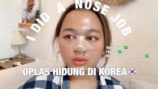 PENGALAMAN OPERASI HIDUNG PESEK DI KOREA spill biaya , clinic dll | I DID A NOSE JOB IN KOREA