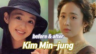 Kim Min-jung before and after