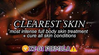 ️XT-011000x MOST INTENSE CLEAR SKIN Subliminal + cure acne & all skin conditions {PURGING}