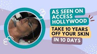 AS SEEN ON ACCESS HOLLYWOOD TAKE 10 YEARS OFF YOUR SKIN IN 10 DAYS | PATIENT STORY | Dr. Jason Emer