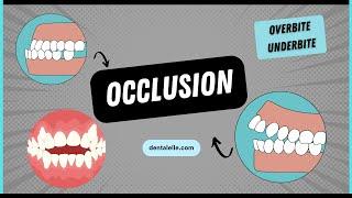 Explaining Dental Occlusion Types, Issues, and Treatments