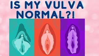 Is my Vulva Normal?! - Girl Talk with Dr. Rejuvenation
