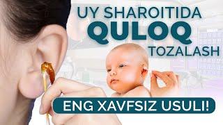 Quloqni  uy sharoitida tozalash, Eng xavfsiz usul!  LOR qabuli 95- 188-86-88