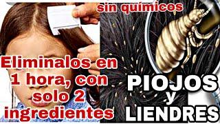 COMO ELIMINE PIOJOS y LIENDRES en una HORA con 2 INGREDIENTES que tienes en casa, SIN QUIMICOS