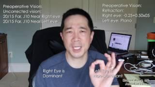 2 weeks after symfony lens. First-hand experience from ophthalmologist - Shannon Wong, MD.  Vlog #15