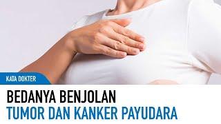 Kenali Gejala Tumor Sebelum Menjadi Kanker! | Kata Dokter