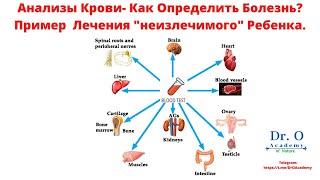 Анализы Крови - Как Определить Болезнь? Пример Лечения "Неизлечимой" Болезни Ребенка