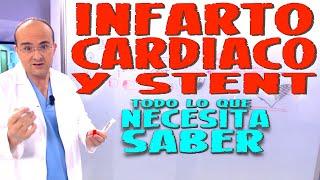 INFARTO CARDIACO Y STENT - Todo lo que necesita saber - Enfermedades #29