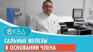  Сальные железы в основании члена. Клинический случай №775