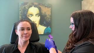 Botox full face training video
