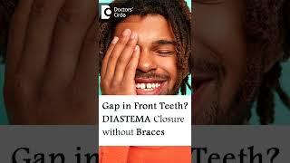 Close Gap Between Front Teeth Without Braces-Dr.Manesh Chandra Sharma|Doctors' Circle #shorts