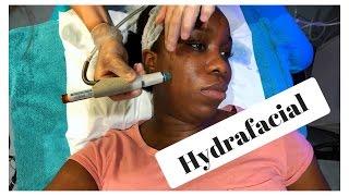 VLOG: Hydrafacial for Acne