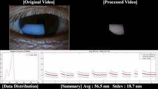 Image-based quantitative analysis of tear film lipid layer thickness for meibomian gland evaluation