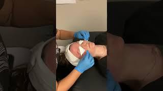 Glycolic Chemical Peel #2 (Nikki Duaban)