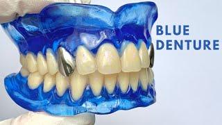 Blue Dentures