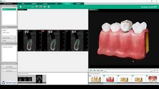 Software Ez3D-i : Ez-Codi