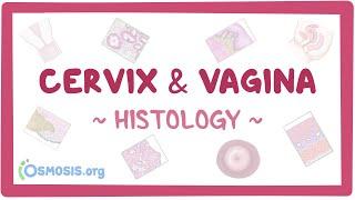 Cervix and vagina: Histology