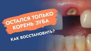 Остался только корень зуба. Как восстановить?