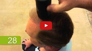 Thinning Hair Solution In Seconds