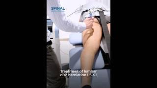 Treatment of Lumbar Hernia L5/S1