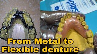 From Metal Framework to Flexible Denture l  DatuAmbasTv