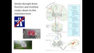 Dr Allie Turton - Stroke rehabilitation: The corticospinal tract and beyond