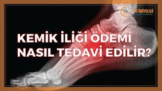 KEMİK İLİĞİ ÖDEMİ NASIL TEDAVİ EDİLİR?