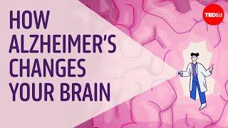 Can you prevent Alzheimer's disease? - Krishna Sudhir