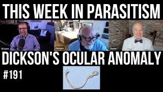 TWiP 191: Dickson's ocular anomaly